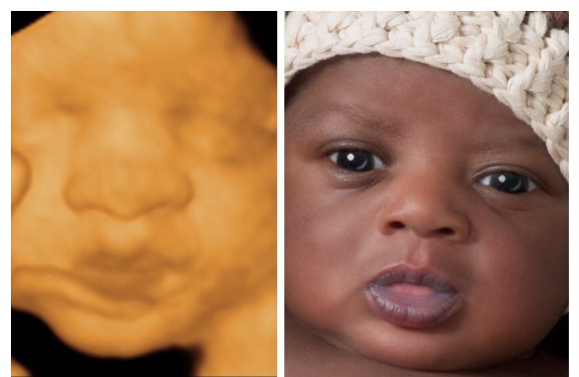 photo 1 3D 4D HD Ultrasound Virginia