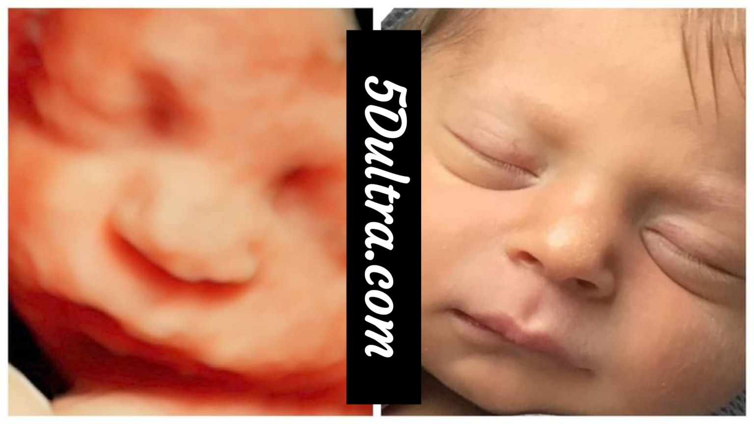 3D 4D Ultrasound Near me | 3D 4D HD Ultrasound Virginia